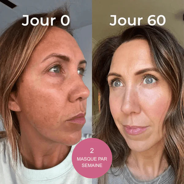Bio-collagène masque (offres +5 limités)