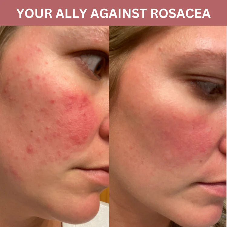 Bio-collagène masque (offres +5 limités)